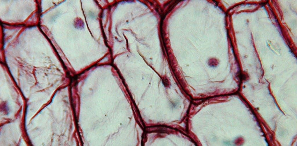 Light photomicrograph of an Onion epidermus cells seen through a microscope